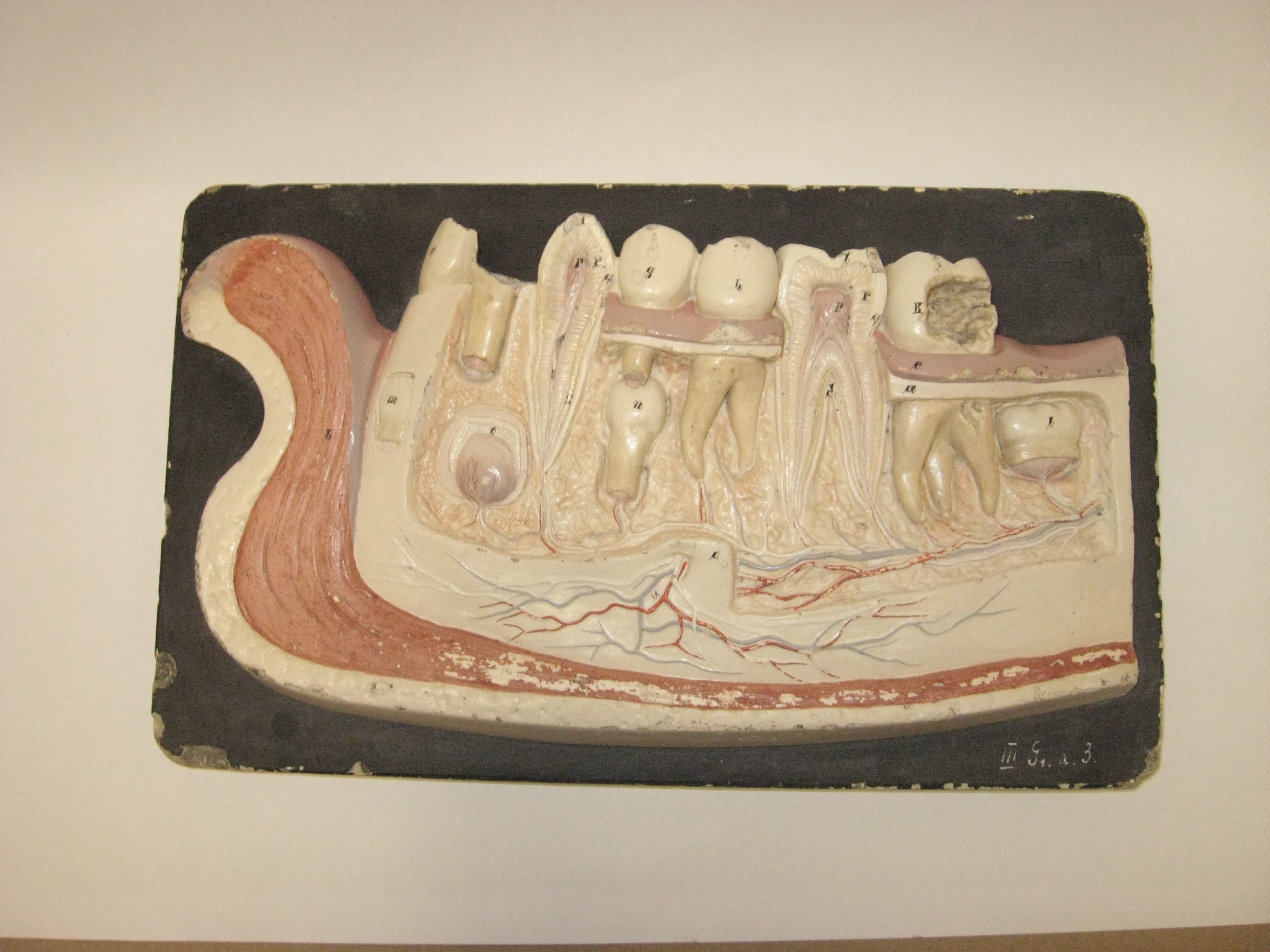 An odontological model showing a cross-section of the jaw with dentition and nerves.